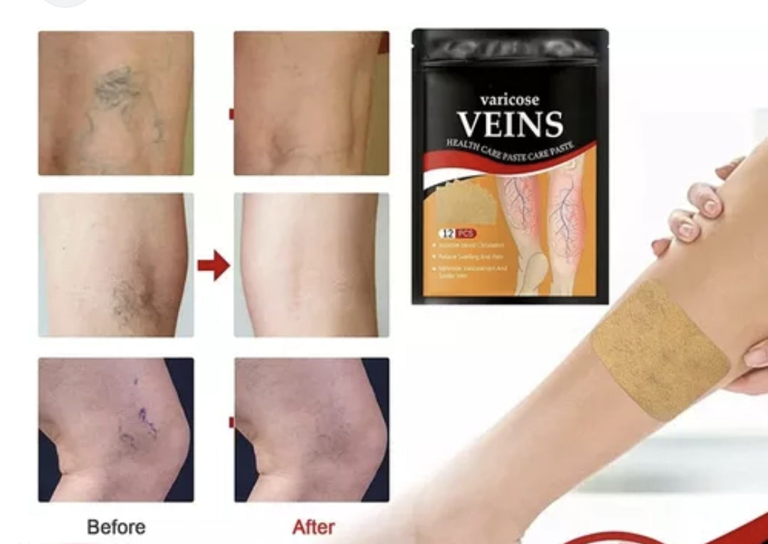 Parche Venas Varices Winner – Alivio Natural para Piernas Cansadas